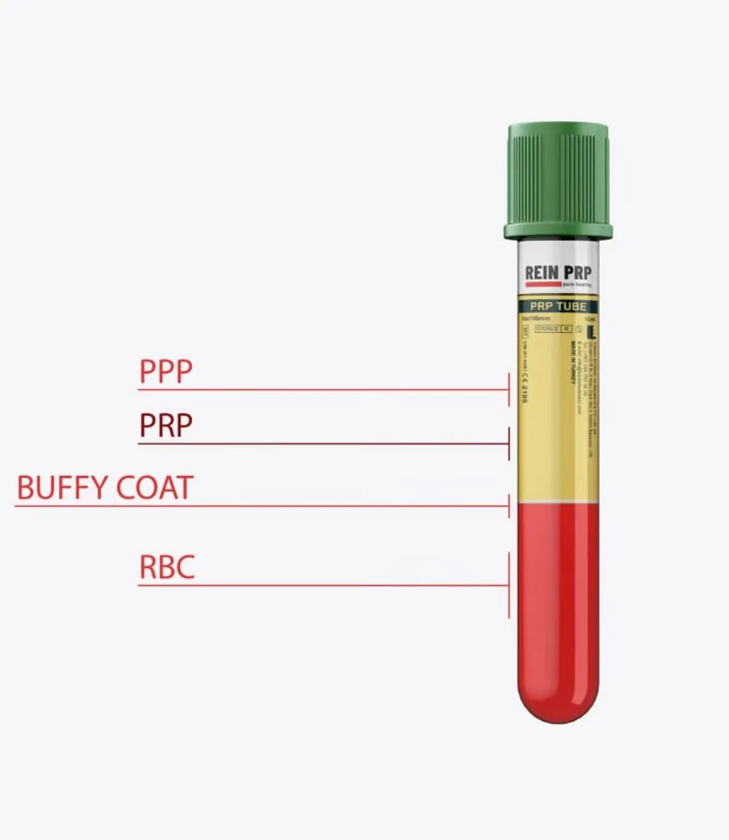 A comparison graphic showing a CE-certified medical PRP tube next to a standard blood collection tube, highlighting the differences for UK clinicians.