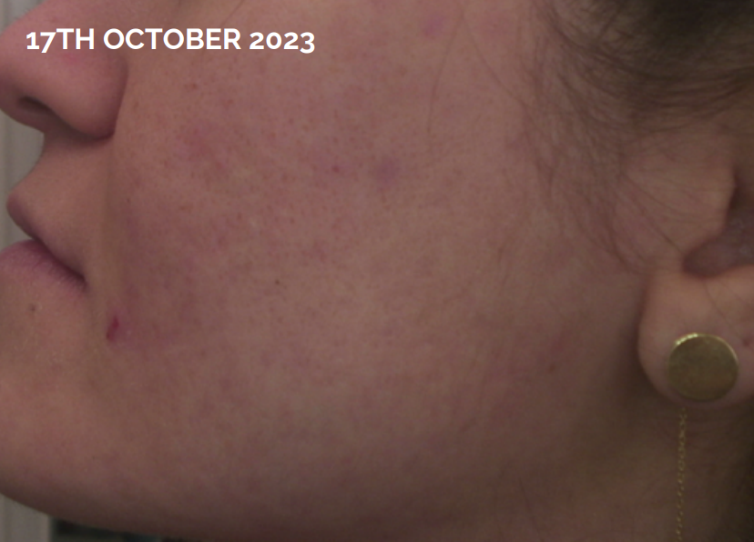 Screenshot 2024-10-18 at 18.26.21